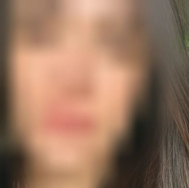 Siri, 36